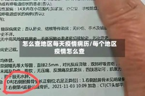 怎么查地区每天疫情病历/每个地区疫情怎么查